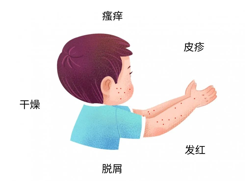 这些症状都可能是宝宝过敏传递的信号，，很多宝妈还不知道